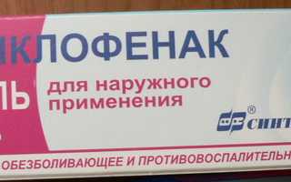 Медикаментозное лечение артрита