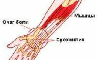 Заболевания лучезапястного сустава