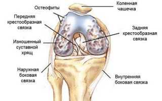 Какие хондропротекторы лучше при артрозе