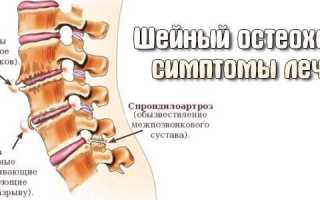 Какие симптомы при шейном и грудном остеохондрозе