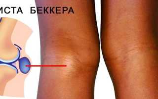 Нога болит при сгибании