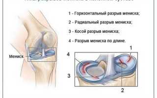 После бега болят колени