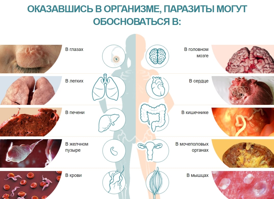 Очистка организма от паразитов в домашних условиях