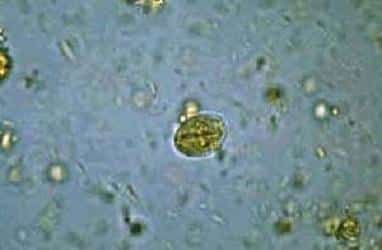 Лямблии у взрослых: причины, симптомы, лечение, профилактика