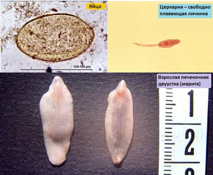 Виды паразитов в воде и их опасность для человека