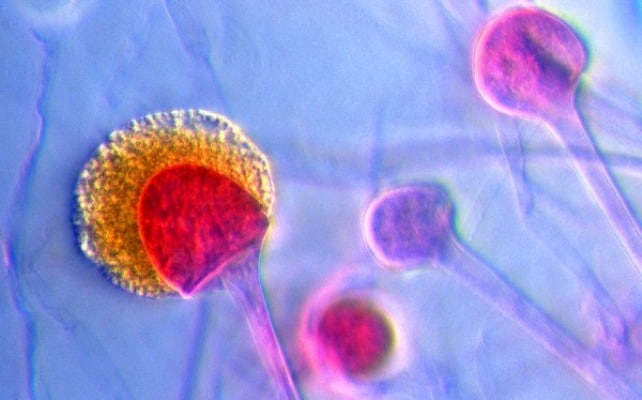 Виды паразитов в воде и их опасность для человека