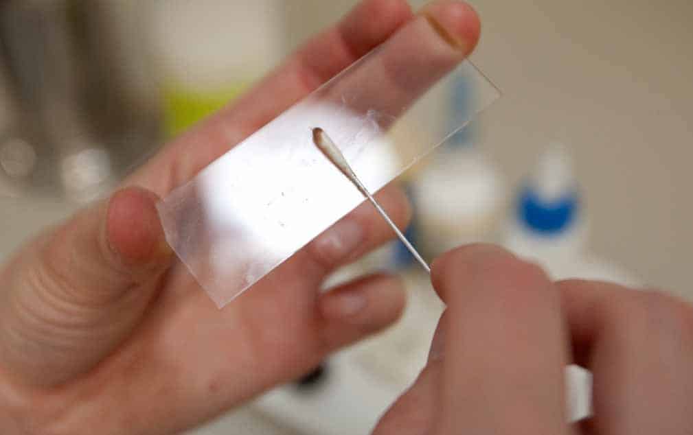 Диагностика паразитов в организме: анализы и исследования