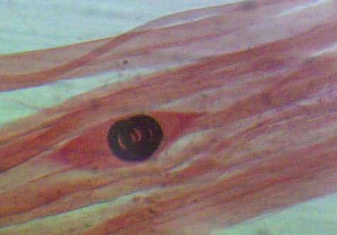 Как осуществляется проверка мяса на трихинеллез?