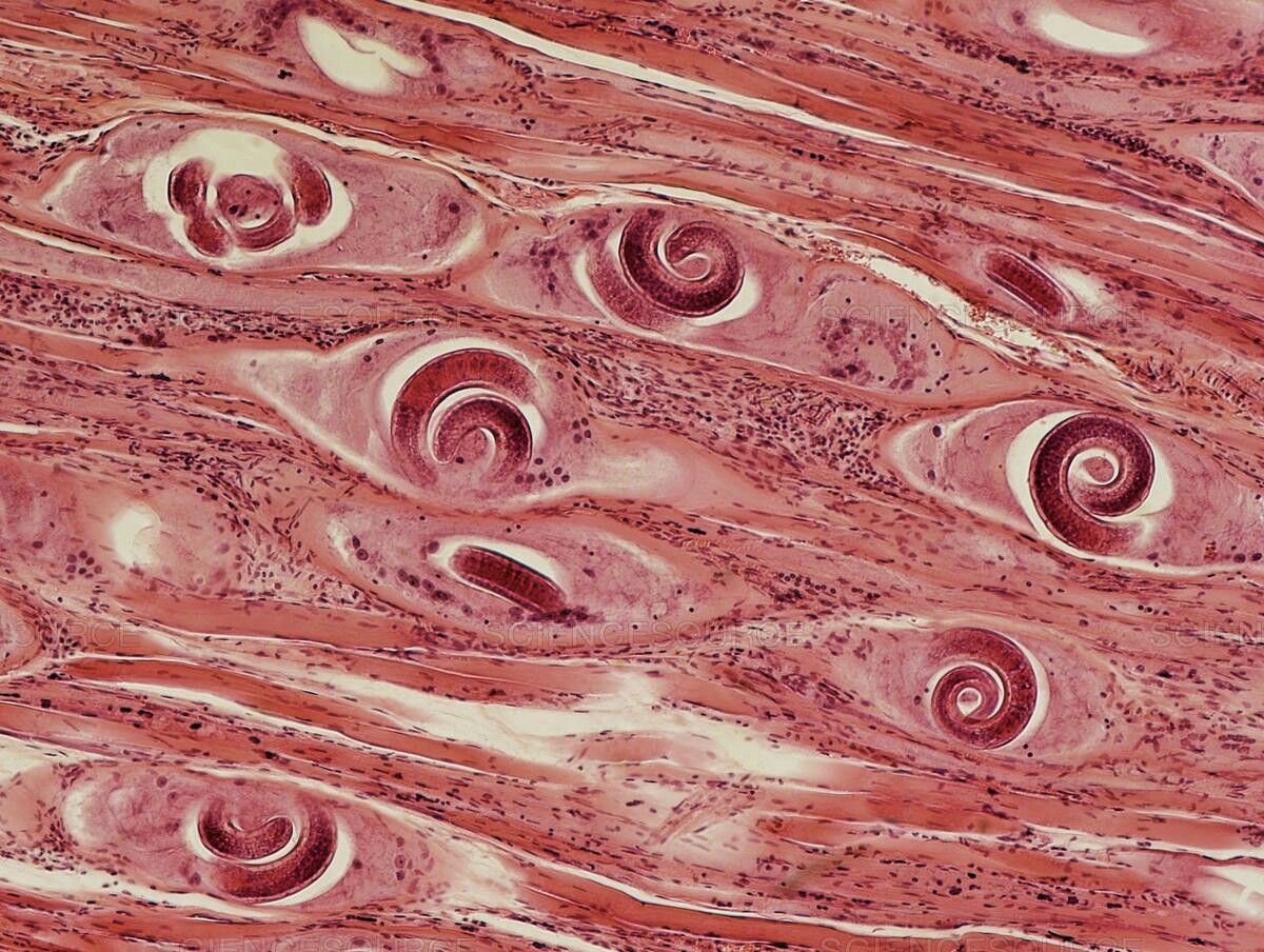 Виды паразитов и симптомы. Основные признаки наличия паразитов в организме