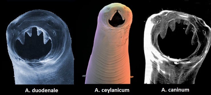 Какие бывают паразиты в суставах человека