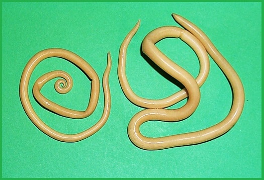 Паразиты в кишечнике человека