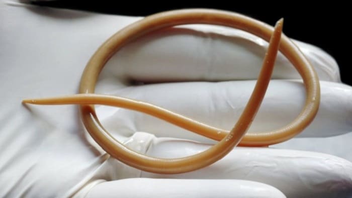 Какие бывают паразиты в суставах человека