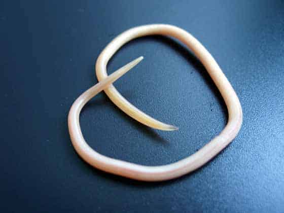 Какие могут быть паразиты в сердце человека?