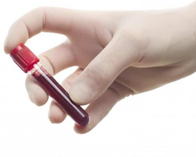 Какой анализ на эхинококкоз более точный?