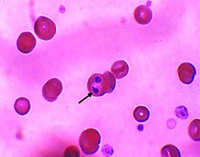 Чем вызывается бабезиоз у человека?