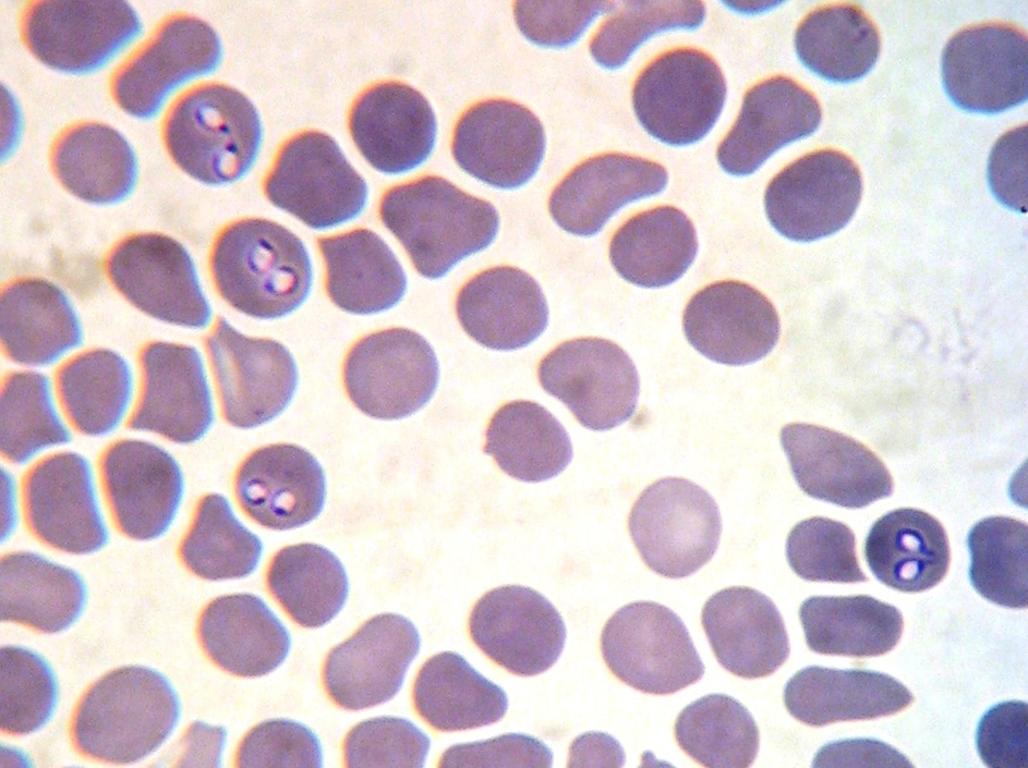 Как протекает бабезиоз крупного рогатого скота?