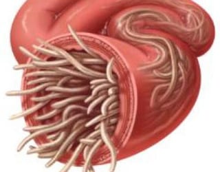 beremennost-i-glisty