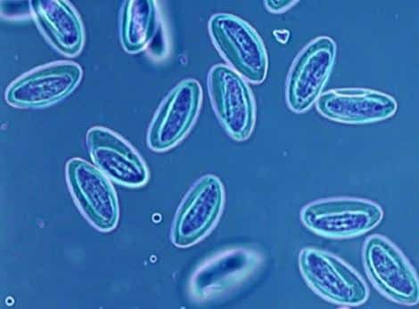 Бластоцистоз: внутренние и внешние причины появления, симптомы, лечение