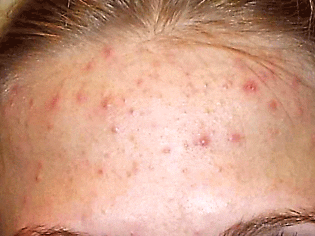 Проявления