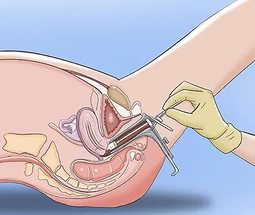 Как проявляется трихомониаз: симптомы у женщин и диагностика болезней?