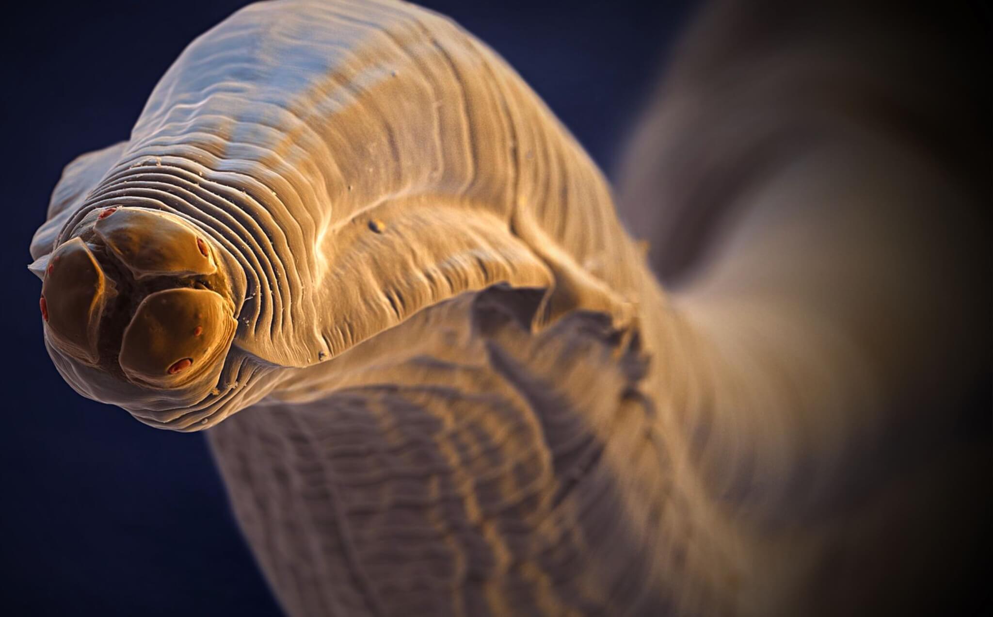 Виды паразитов и симптомы. Основные признаки наличия паразитов в организме