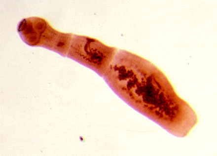 Как лечить паразитов в почках?