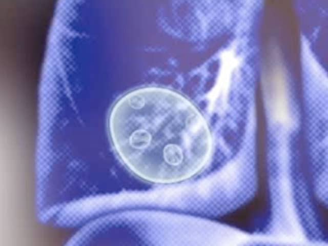 Как лечить эхинококкоз легких у человека