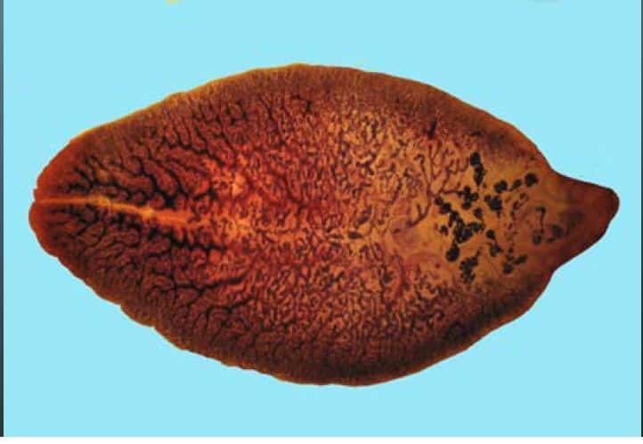 Как развивается фасциолез человека?