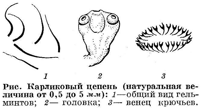 Как протекает гименолепидоз?