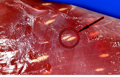 glisty-v-pecheni-foto