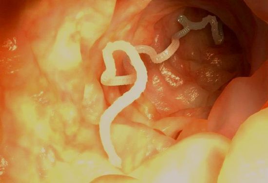 glisty-vo-vlagalishe