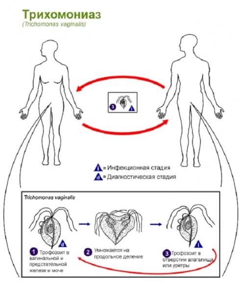Что такое трихомониаз и как от него излечиться?