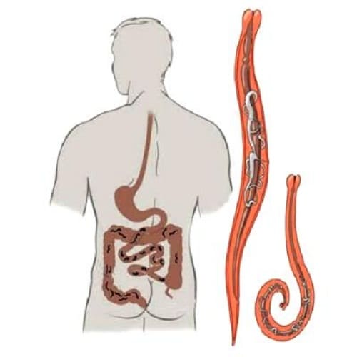 kak-dolgo-zhivut-parazity