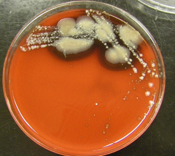 колонии гриба кандида