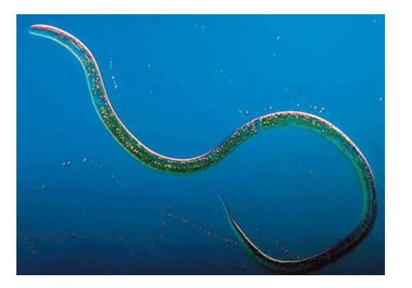 Какие встречаются паразиты в желудке у человека