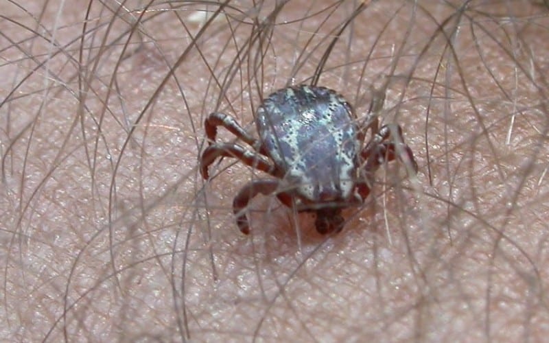 Паразиты в волосах: симптомы и меры по выведению