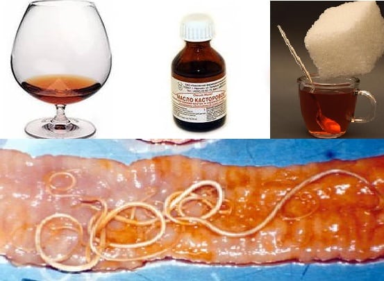 Лечение паразитов