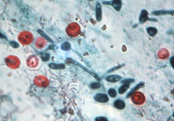 Как проявляется криптоспоридиоз у животных?