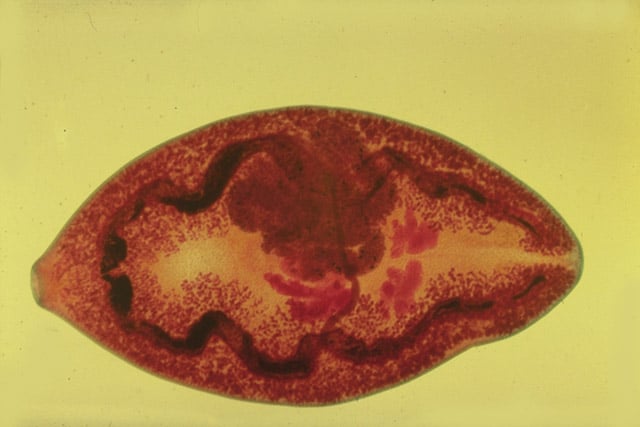 легочная двуустка