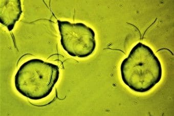 Виды и проявление простейших паразитов