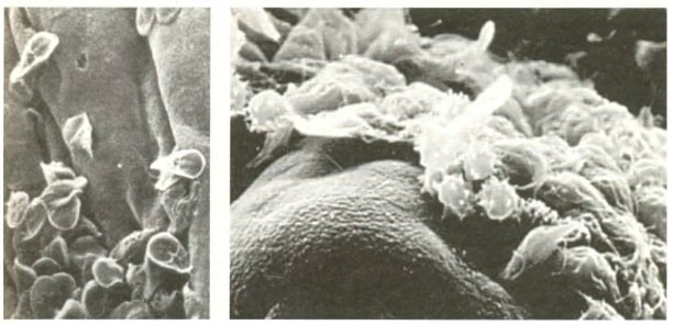 В кишечнике