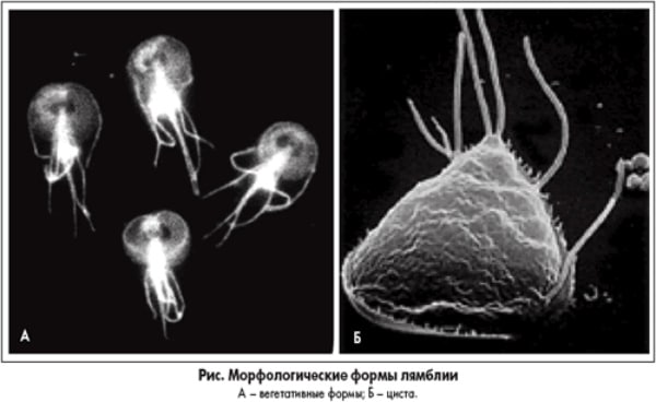 Лямблии у взрослых: причины, симптомы, лечение, профилактика