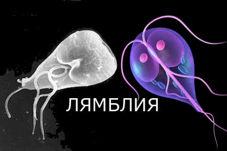 Лямблии у взрослых: причины, симптомы, лечение, профилактика
