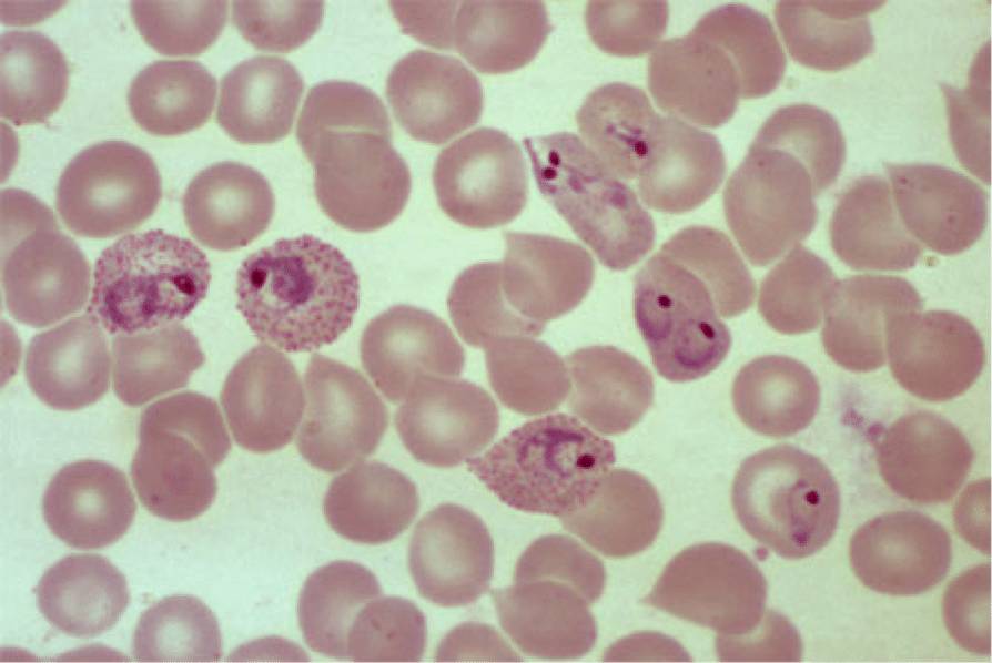 Кровь под микроскопом