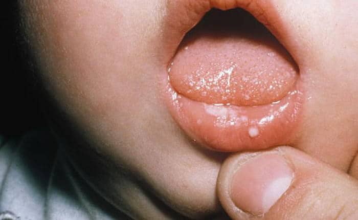 следите за поведением малыша