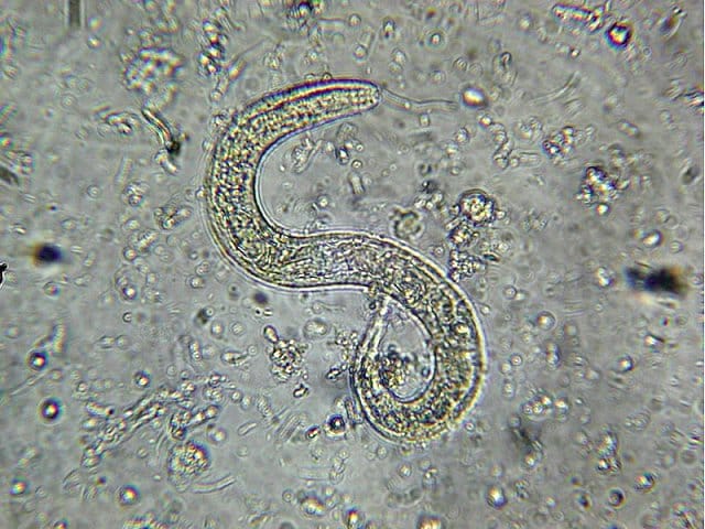 mozhno-li-umeret-ot-glistov