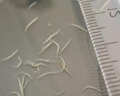 Как выглядят и развиваются острицы у человека?