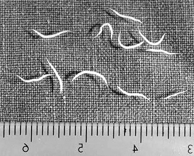 Чем отличаются острицы от аскарид и их сходства