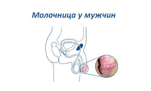 Паразиты на члене: причины и лечение