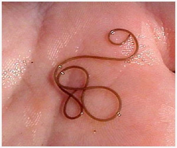 Паразиты у детей: как их обнаружить и лечить?